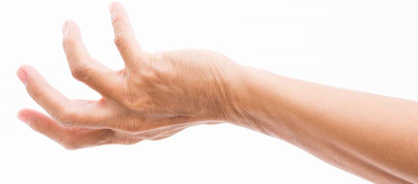 main of A Grasping Hand Deformity Could be Dupuytren's Contracture