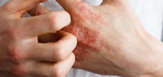 thumbnail of Skin Conditions & Skin Health