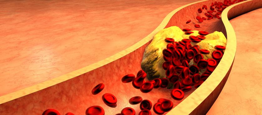 main of Cholesterol Is Still One of the most Misunderstood Aspects of Health