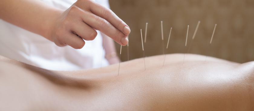 main of Acupuncture Brings Relief to Many People