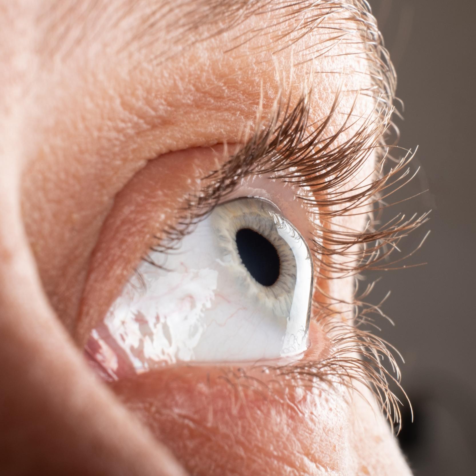 banner of Undergoing a Cornea Transplant Can Help Restore Vision To Some People
